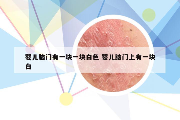 婴儿脑门有一块一块白色 婴儿脑门上有一块白