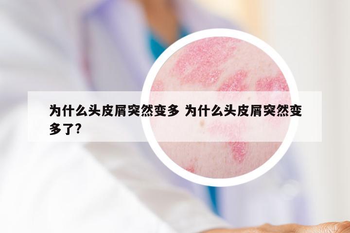 为什么头皮屑突然变多 为什么头皮屑突然变多了?