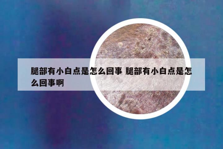 腿部有小白点是怎么回事 腿部有小白点是怎么回事啊