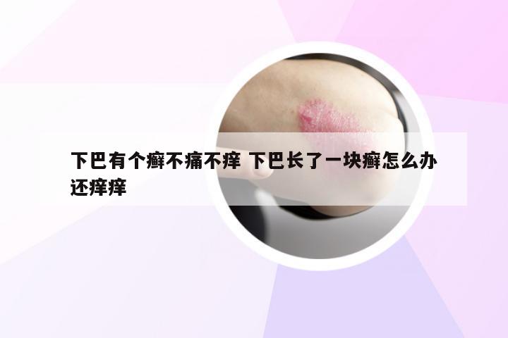 下巴有个癣不痛不痒 下巴长了一块癣怎么办还痒痒