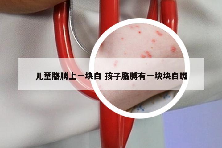 儿童胳膊上一块白 孩子胳膊有一块块白斑