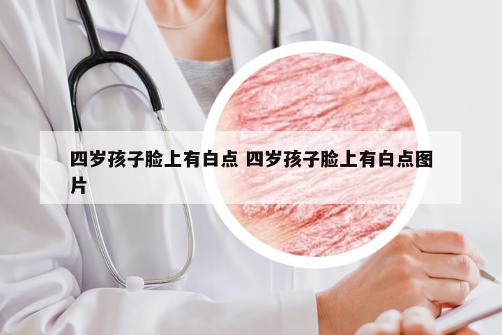 四岁孩子脸上有白点 四岁孩子脸上有白点图片