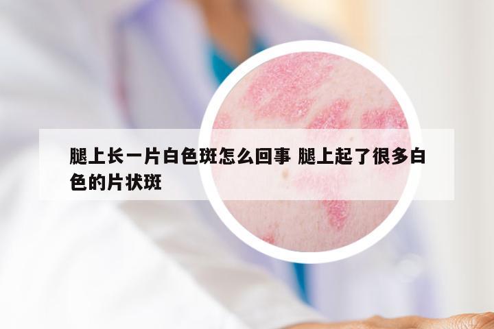 腿上长一片白色斑怎么回事 腿上起了很多白色的片状斑