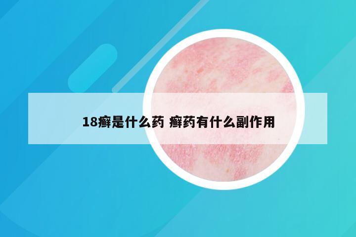 18癣是什么药 癣药有什么副作用