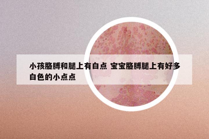 小孩胳膊和腿上有白点 宝宝胳膊腿上有好多白色的小点点