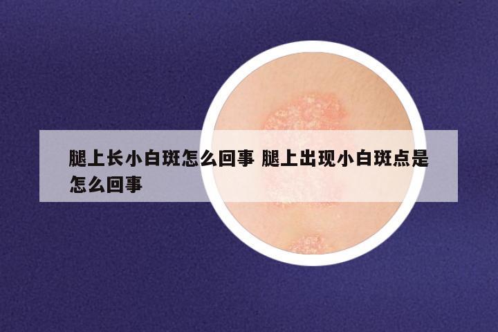 腿上长小白斑怎么回事 腿上出现小白斑点是怎么回事