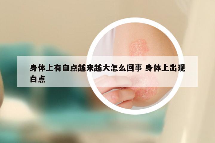 身体上有白点越来越大怎么回事 身体上出现白点