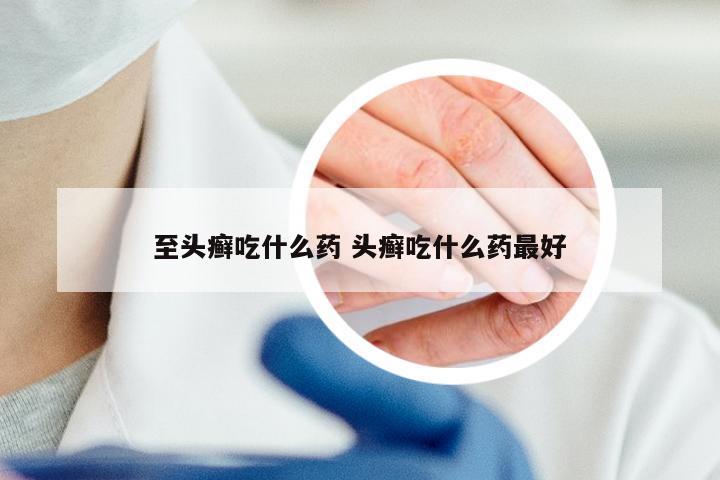 至头癣吃什么药 头癣吃什么药最好