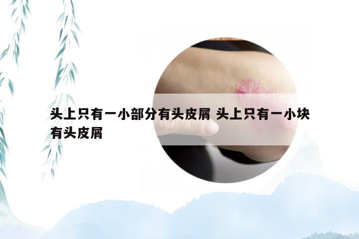 头上只有一小部分有头皮屑 头上只有一小块有头皮屑