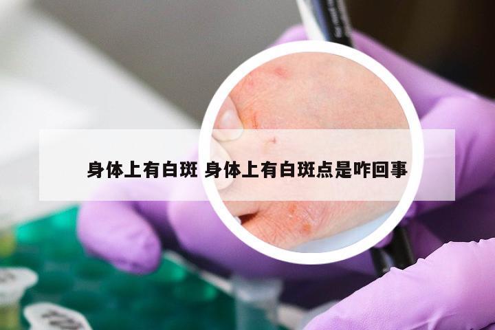 身体上有白斑 身体上有白斑点是咋回事