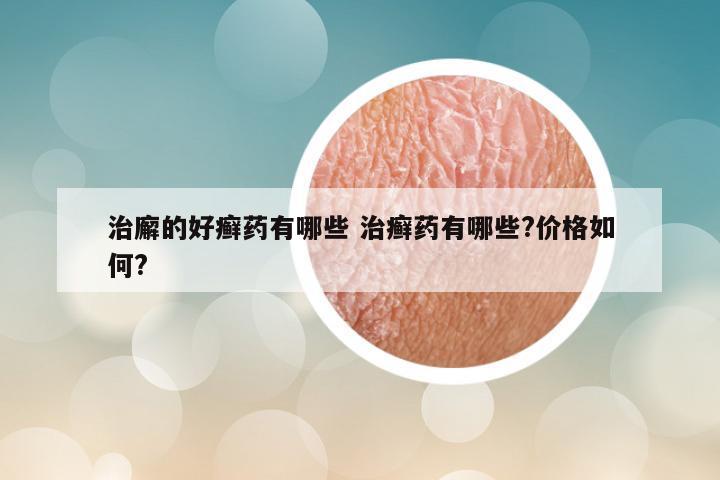 治廨的好癣药有哪些 治癣药有哪些?价格如何?