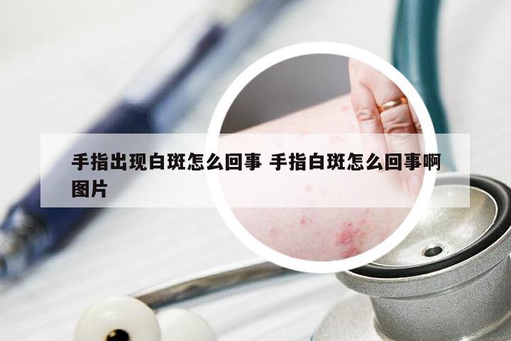 手指出现白斑怎么回事 手指白斑怎么回事啊图片