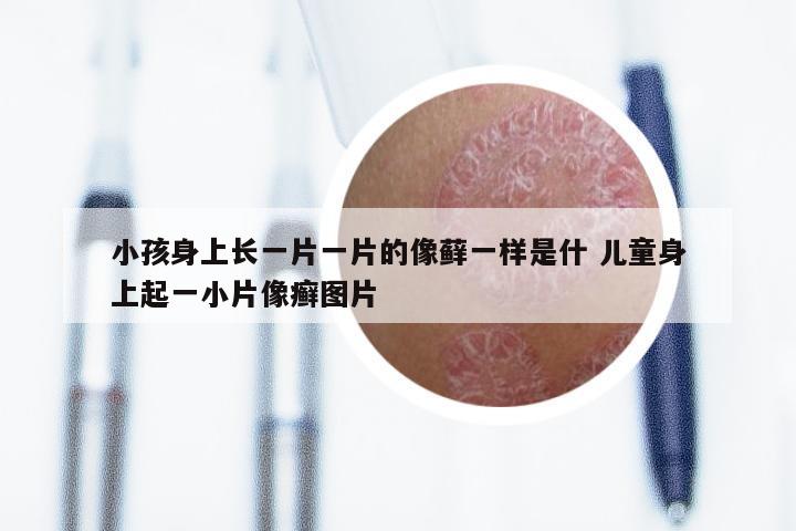 小孩身上长一片一片的像藓一样是什 儿童身上起一小片像癣图片