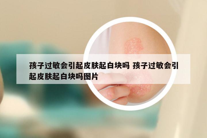 孩子过敏会引起皮肤起白块吗 孩子过敏会引起皮肤起白块吗图片