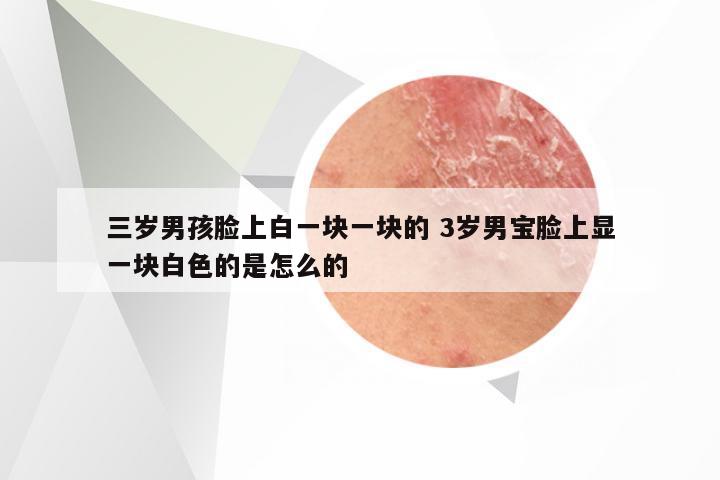 三岁男孩脸上白一块一块的 3岁男宝脸上显一块白色的是怎么的