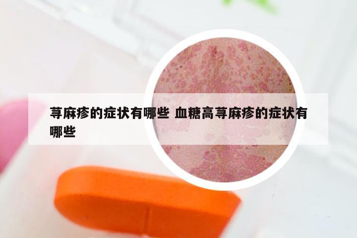 荨麻疹的症状有哪些 血糖高荨麻疹的症状有哪些