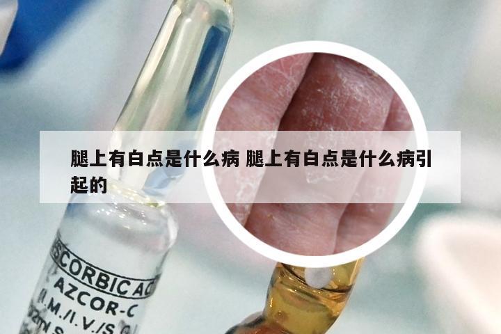 腿上有白点是什么病 腿上有白点是什么病引起的