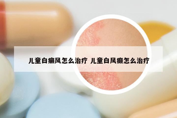 儿童白癞风怎么治疗 儿童白风癫怎么治疗