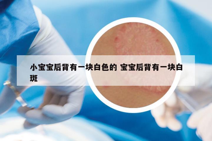 小宝宝后背有一块白色的 宝宝后背有一块白斑