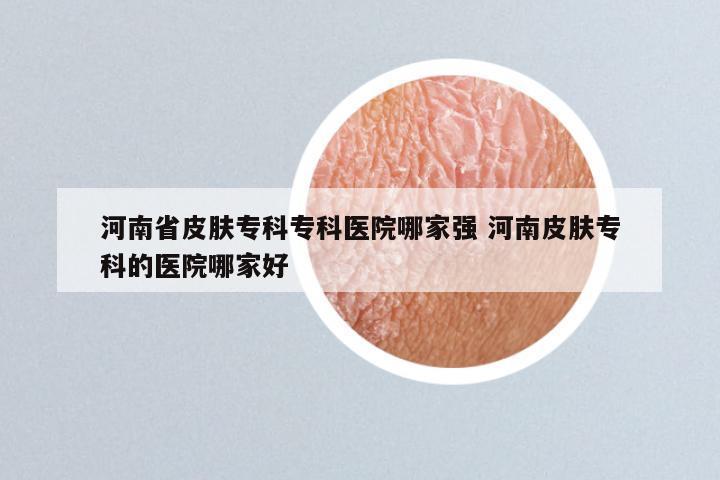 河南省皮肤专科专科医院哪家强 河南皮肤专科的医院哪家好