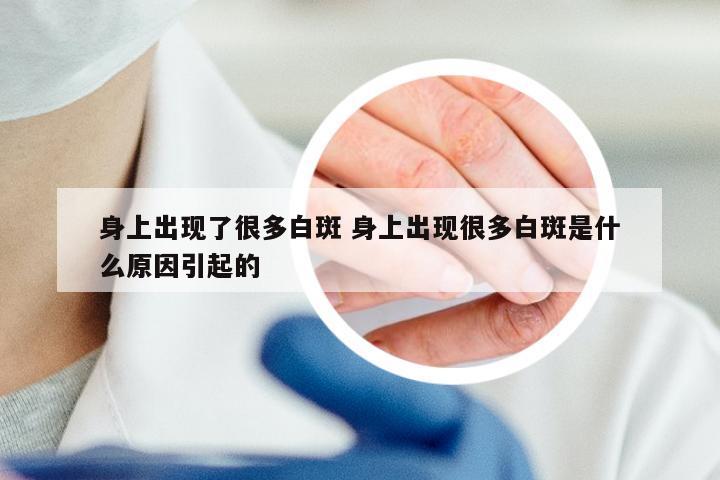 身上出现了很多白斑 身上出现很多白斑是什么原因引起的