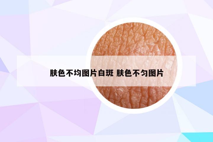 肤色不均图片白斑 肤色不匀图片