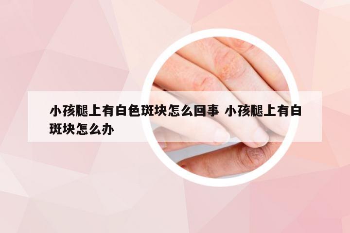 小孩腿上有白色斑块怎么回事 小孩腿上有白斑块怎么办