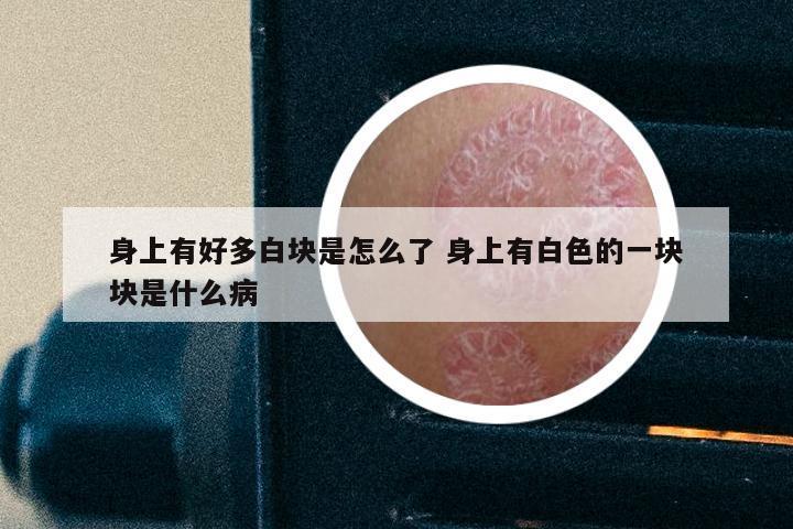 身上有好多白块是怎么了 身上有白色的一块块是什么病