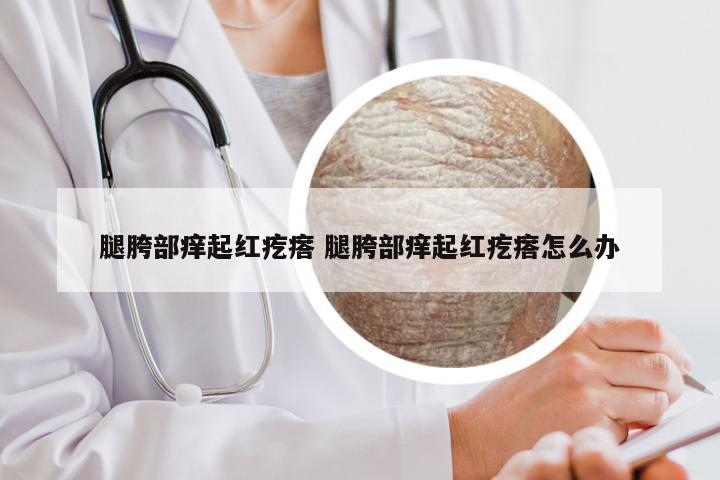 腿胯部痒起红疙瘩 腿胯部痒起红疙瘩怎么办