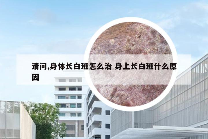 请问,身体长白班怎么治 身上长白班什么原因