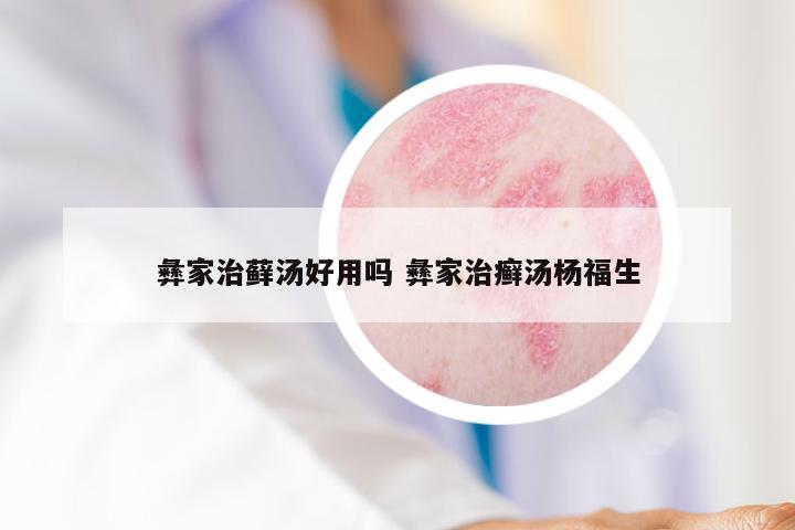 彝家治藓汤好用吗 彝家治癣汤杨福生