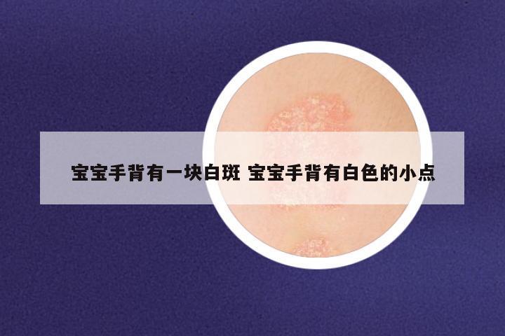 宝宝手背有一块白斑 宝宝手背有白色的小点