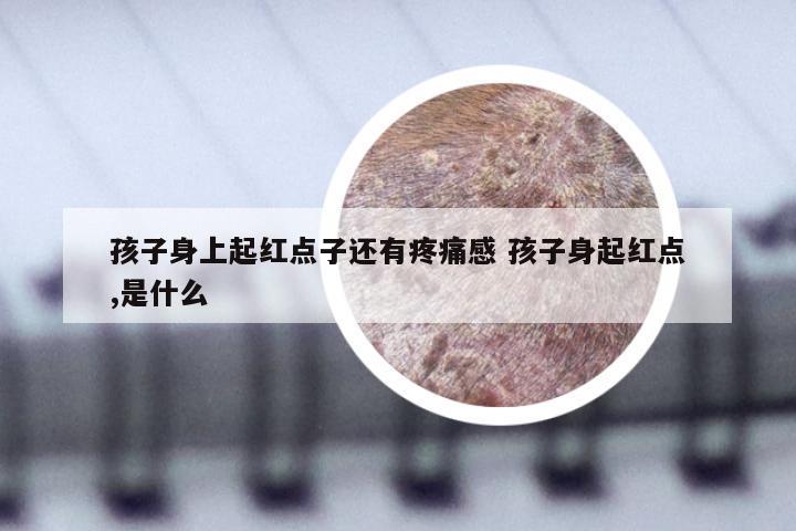 孩子身上起红点子还有疼痛感 孩子身起红点,是什么