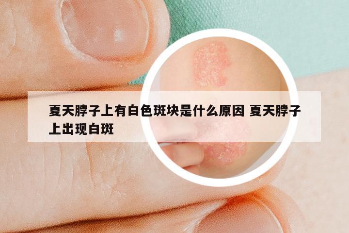 夏天脖子上有白色斑块是什么原因 夏天脖子上出现白斑