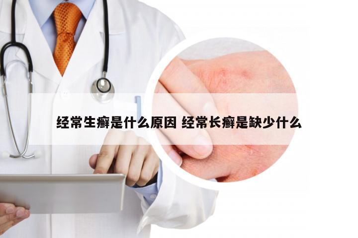 经常生癣是什么原因 经常长癣是缺少什么