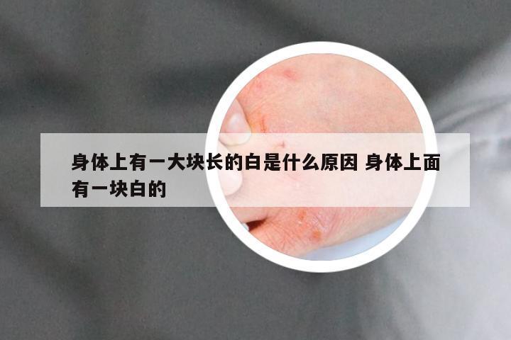 身体上有一大块长的白是什么原因 身体上面有一块白的