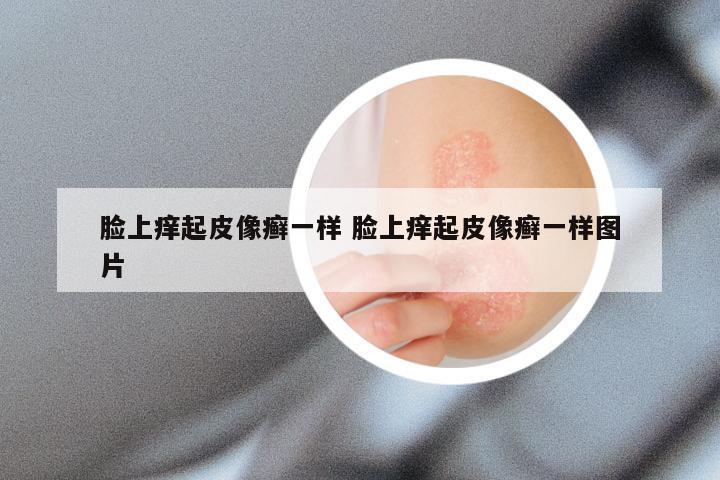 脸上痒起皮像癣一样 脸上痒起皮像癣一样图片