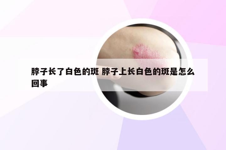 脖子长了白色的斑 脖子上长白色的斑是怎么回事