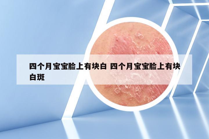 四个月宝宝脸上有块白 四个月宝宝脸上有块白斑