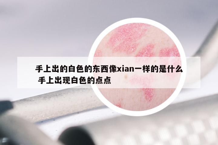 手上出的白色的东西像xian一样的是什么 手上出现白色的点点