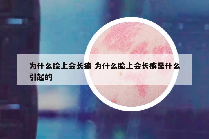 为什么脸上会长癣 为什么脸上会长癣是什么引起的