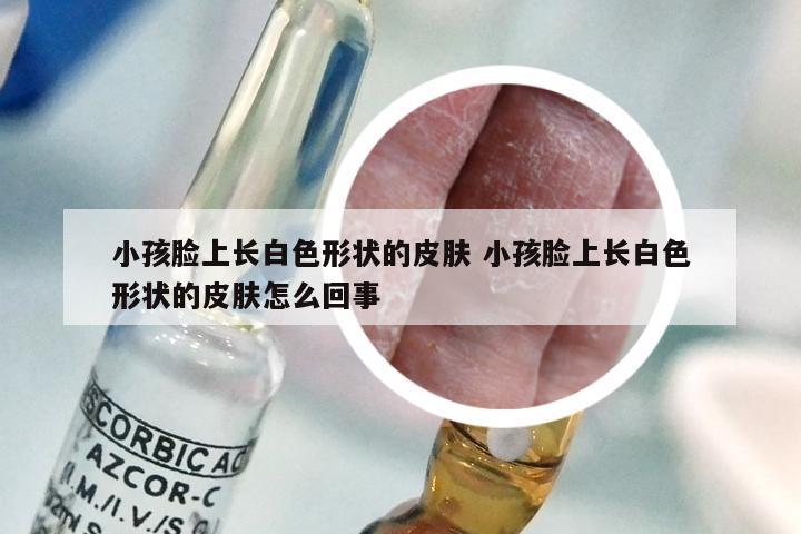 小孩脸上长白色形状的皮肤 小孩脸上长白色形状的皮肤怎么回事