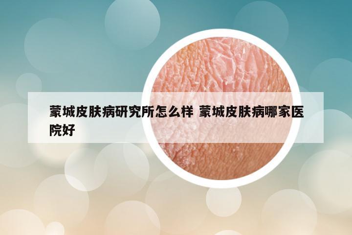 蒙城皮肤病研究所怎么样 蒙城皮肤病哪家医院好