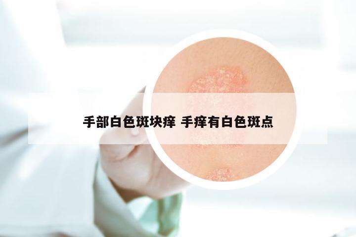 手部白色斑块痒 手痒有白色斑点