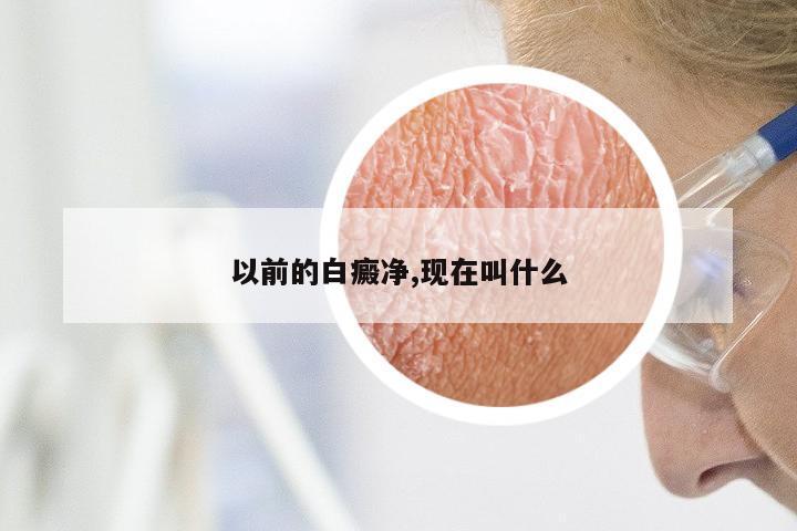 以前的白癜净,现在叫什么