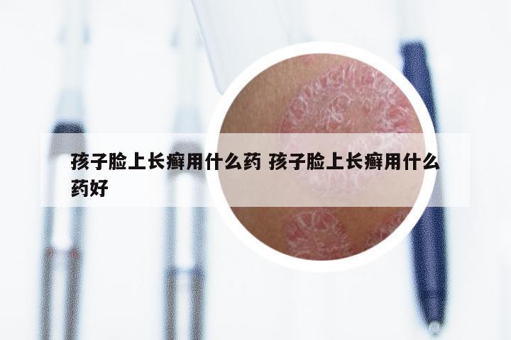 孩子脸上长癣用什么药 孩子脸上长癣用什么药好