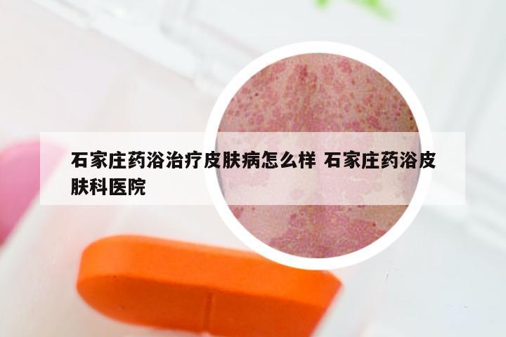 石家庄药浴治疗皮肤病怎么样 石家庄药浴皮肤科医院
