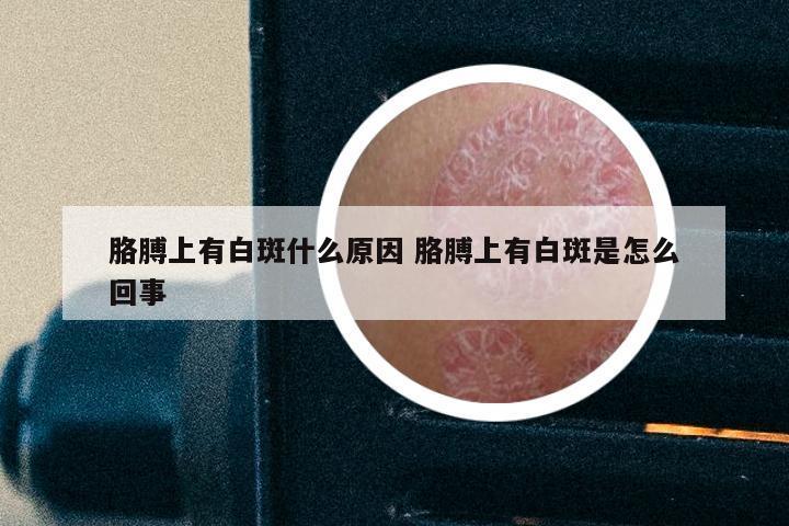 胳膊上有白斑什么原因 胳膊上有白斑是怎么回事