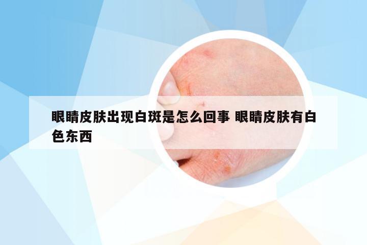 眼睛皮肤出现白斑是怎么回事 眼睛皮肤有白色东西
