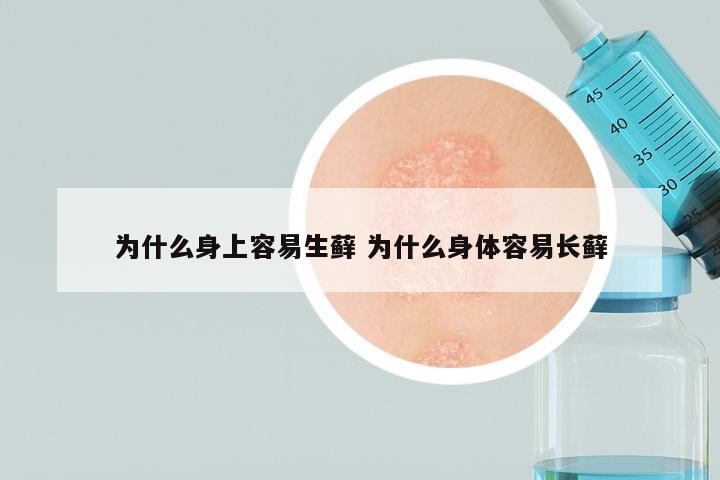 为什么身上容易生藓 为什么身体容易长藓